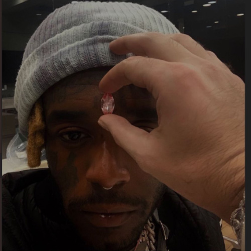 Lil Uzi Vert gets diamond implanted into forehead